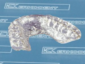 Occlusal Splints